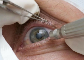 Oftalmologistas alertam para risco de suplementos com promessa de cura