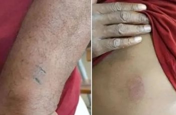 MPT investiga denúncia de tortura em fazenda de Cocos, no oeste da Bahia